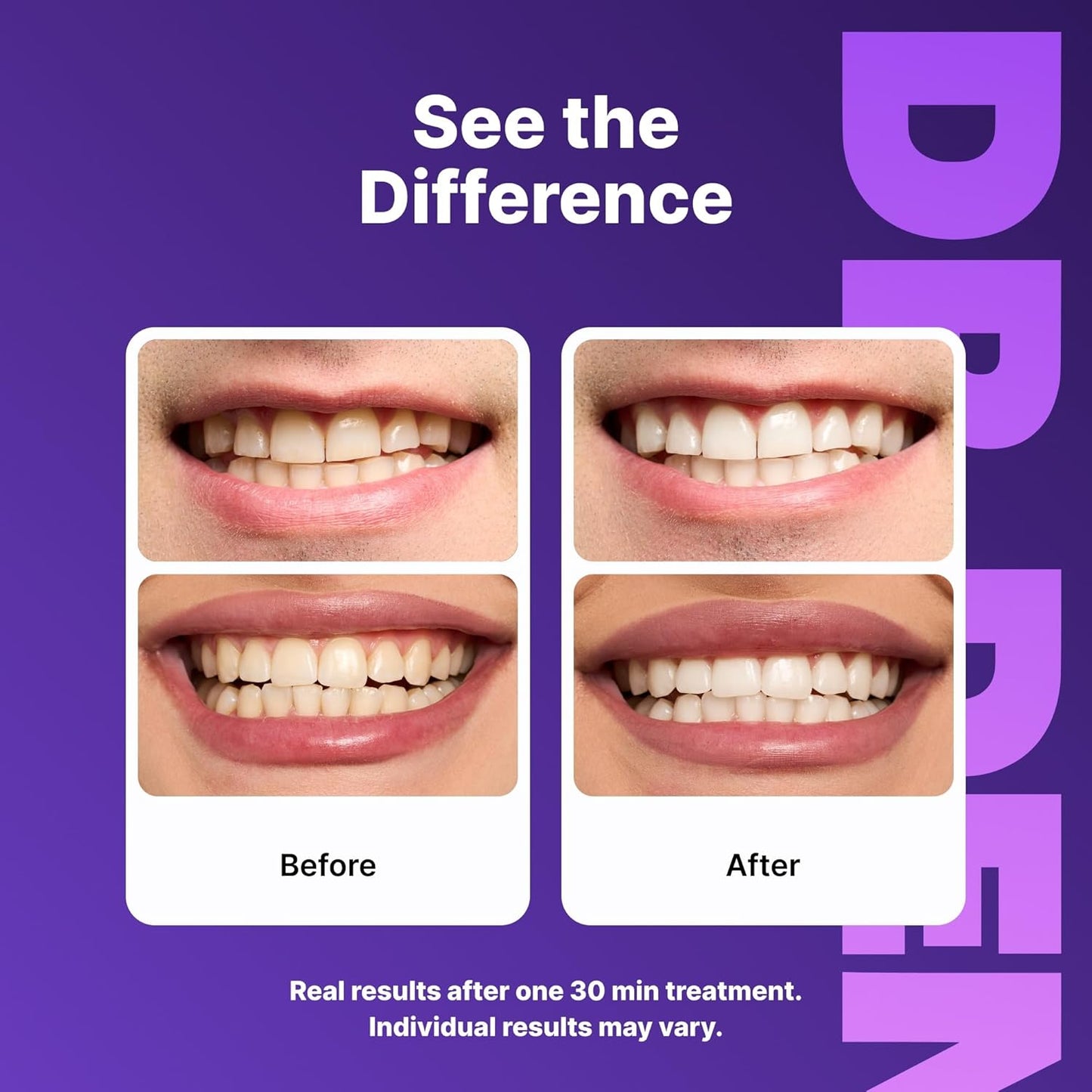 Purple Teeth Whitening Strips - 7/21 Whitening Sessions - Safe for Enamel - Non Sensitive Teeth Whitening - Peroxide-Free